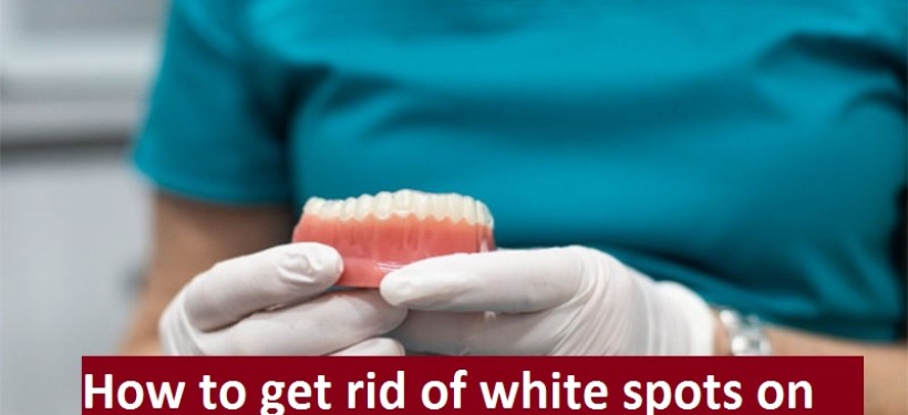How to get rid of white spots on teeth from whitening strips