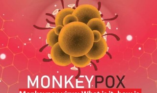 Monkeypox virus: What is it, how is it transmitted, is there a cure?