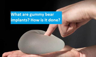 What are gummy bear implants? How is it done?