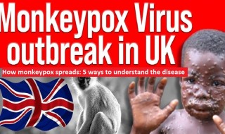 How monkeypox spreads 5 ways to understand the disease